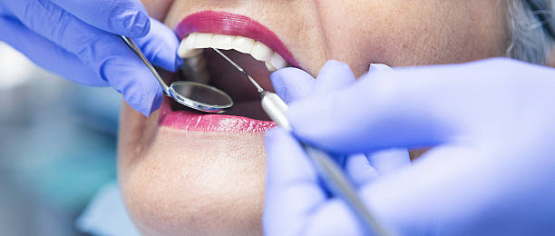 Best Emergency Tooth Extraction in Hastings, MI